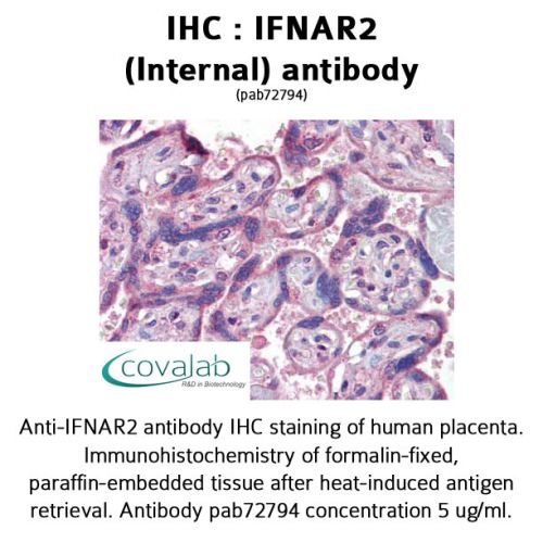 IFNAR2 (Internal) antibody