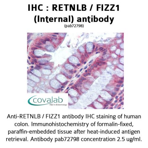 RETNLB / FIZZ1 (Internal) antibody