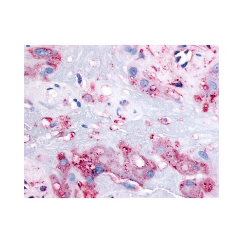 RARB (C-Terminus) antibody