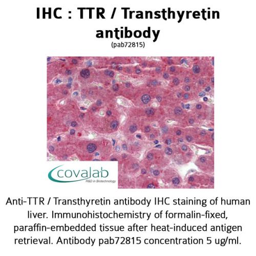 TTR / Transthyretin antibody