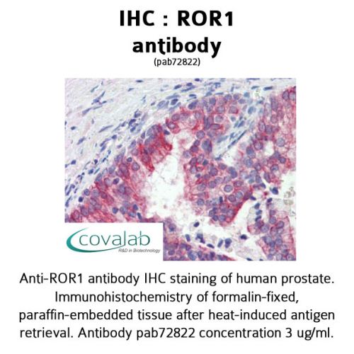 ROR1 antibody