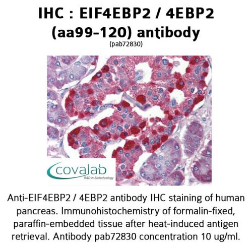 EIF4EBP2 / 4EBP2 (aa99-120) antibody