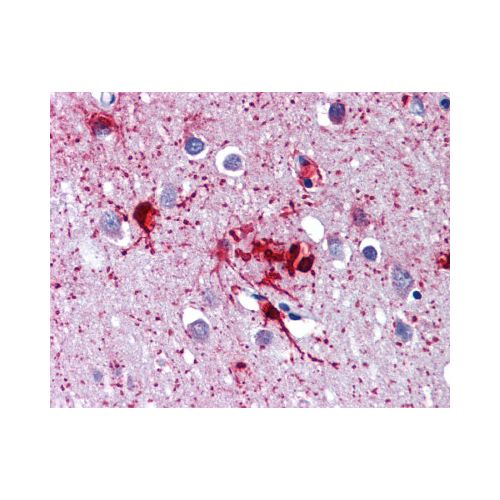 DDX58 antibody
