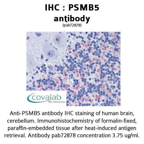 PSMB5 antibody