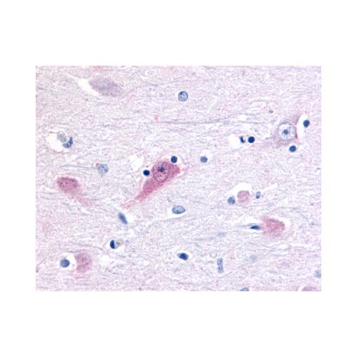 ROR Beta (Ligand-binding Domain) antibody