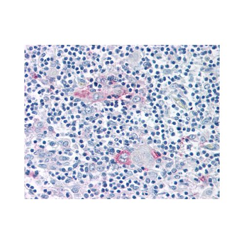 ROR Gamma (Ligand-binding Domain) antibody