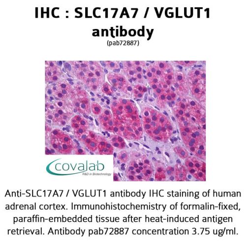 SLC17A7 / VGLUT1 antibody
