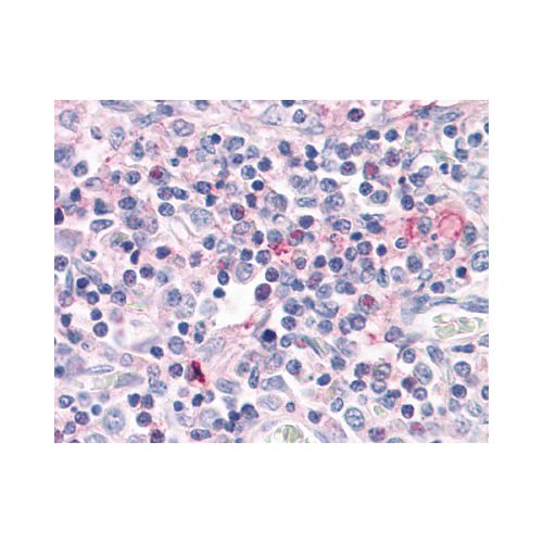ROR Gamma (Ligand-binding Domain) antibody