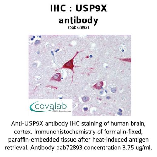 USP9X antibody