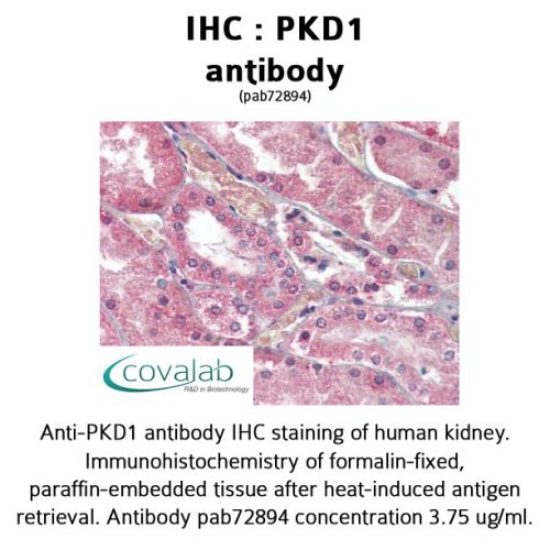 PKD1 antibody