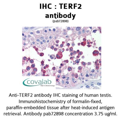 TERF2 antibody