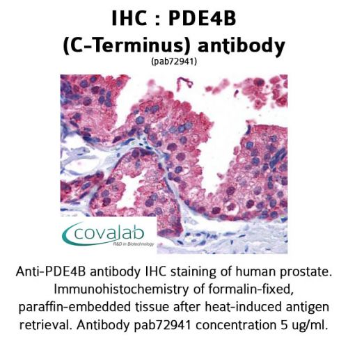 PDE4B (C-Terminus) antibody