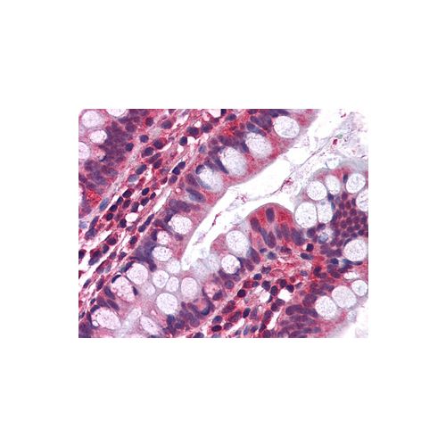 5HT3A receptor (aa428-439) antibody