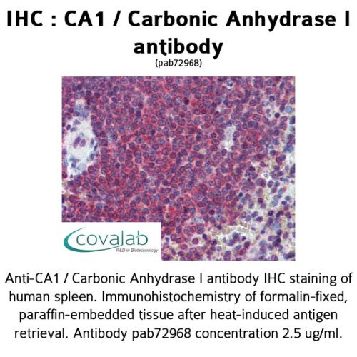 CA1 / Carbonic Anhydrase I antibody