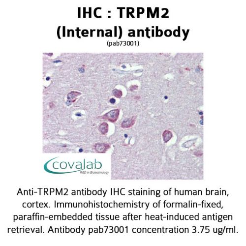 TRPM2 (Internal) antibody