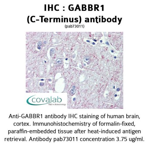 GABBR1 (C-Terminus) antibody