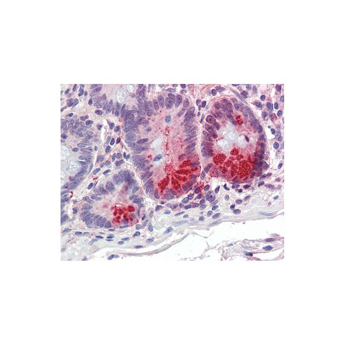 SRD5A1 (Internal) antibody