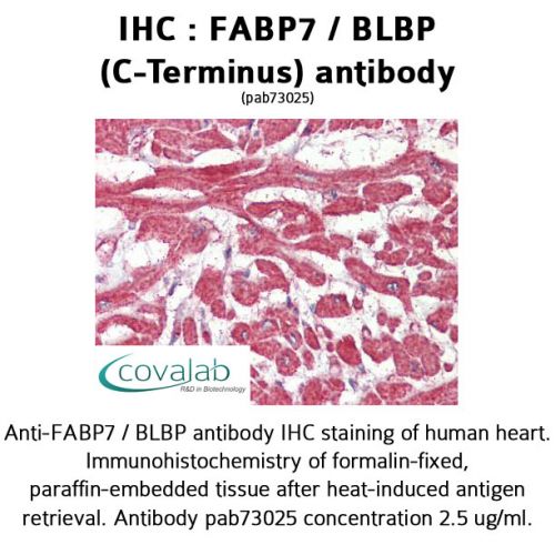 FABP7 / BLBP (C-Terminus) antibody