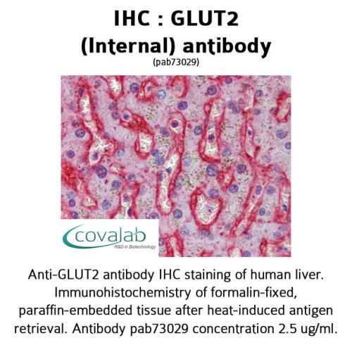 GLUT2 (Internal) antibody