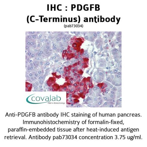 PDGFB (C-Terminus) antibody