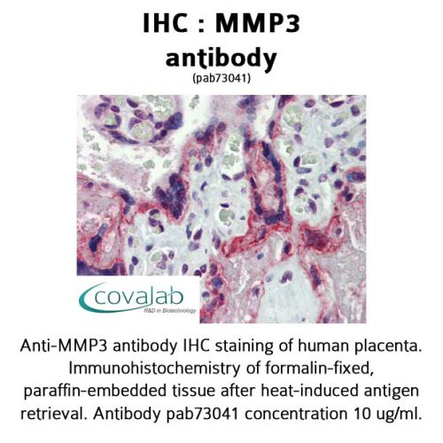 MMP3 antibody