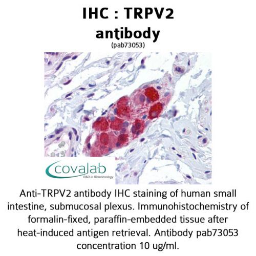 TRPV2 antibody