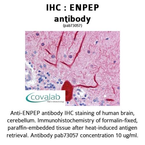 ENPEP antibody