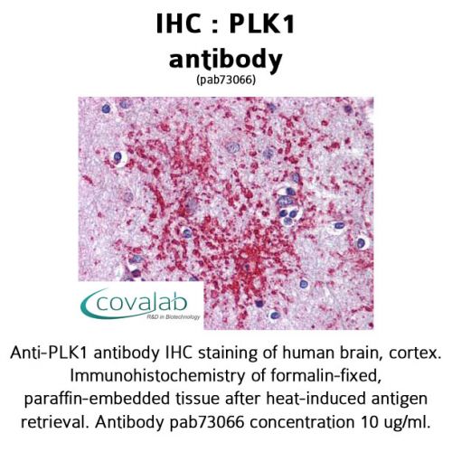 PLK1 antibody