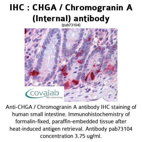 CHGA / Chromogranin A (Internal) antibody