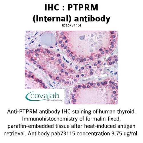 PTPRM (Internal) antibody