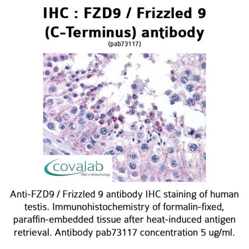 FZD9 / Frizzled 9 (C-Terminus) antibody