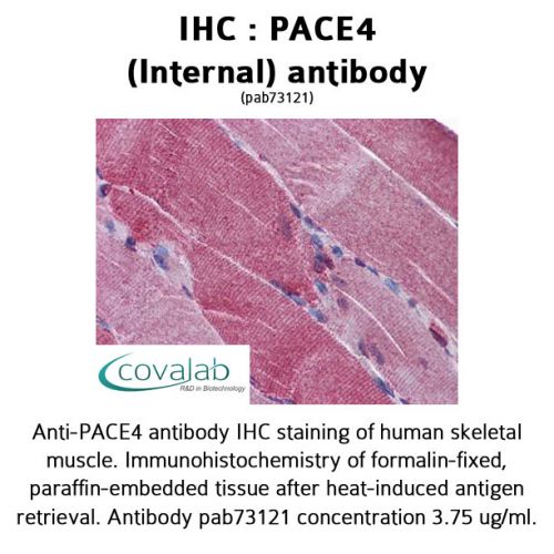 PACE4 (Internal) antibody
