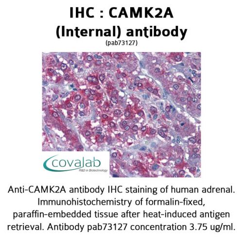 CAMK2A (Internal) antibody
