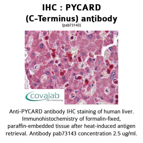 PYCARD (C-Terminus) antibody