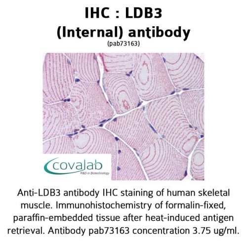 LDB3 (Internal) antibody