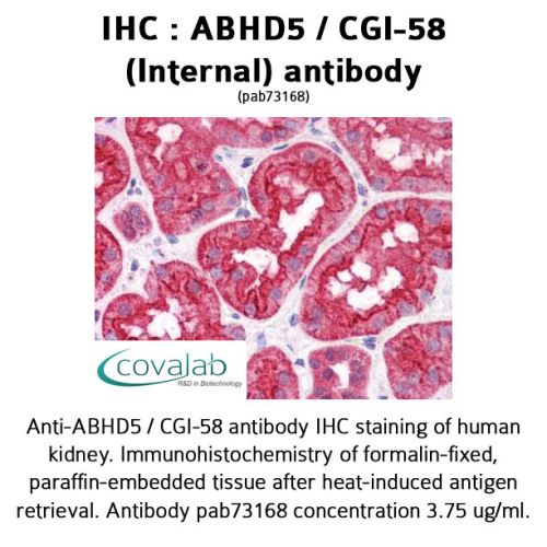 ABHD5 / CGI-58 (Internal) antibody