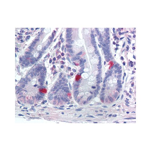 SCN9A / Nav1.7 (Internal) antibody