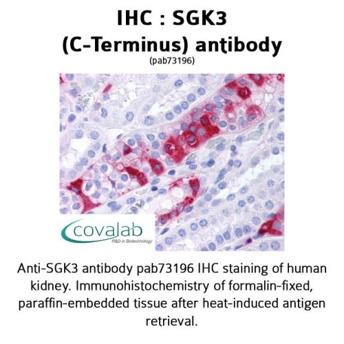 SGK3 (C-Terminus) antibody