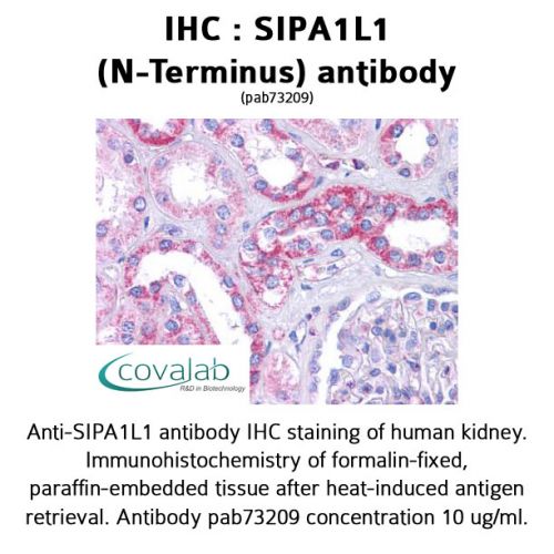 SIPA1L1 (N-Terminus) antibody