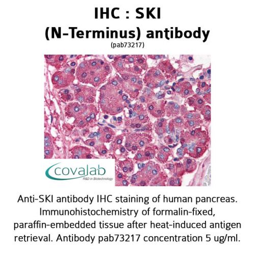 SKI (N-Terminus) antibody
