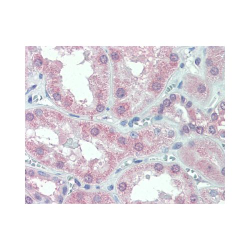 SLC11A2 (C-Terminus) antibody