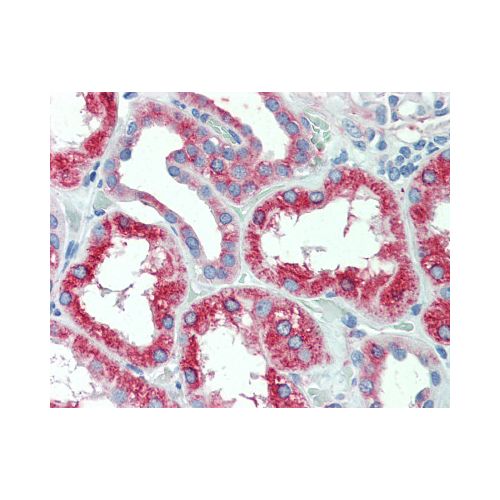 SLC11A2 (Internal) antibody