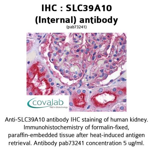 SLC39A10 (Internal) antibody
