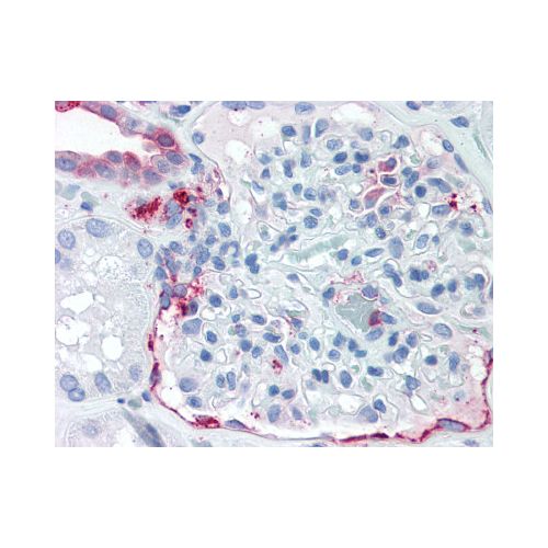 SLC39A14 (Internal) antibody