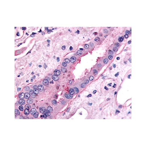 SLC5A2 (C-Terminus) antibody