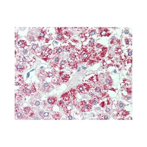 SLC7A2 (Internal) antibody