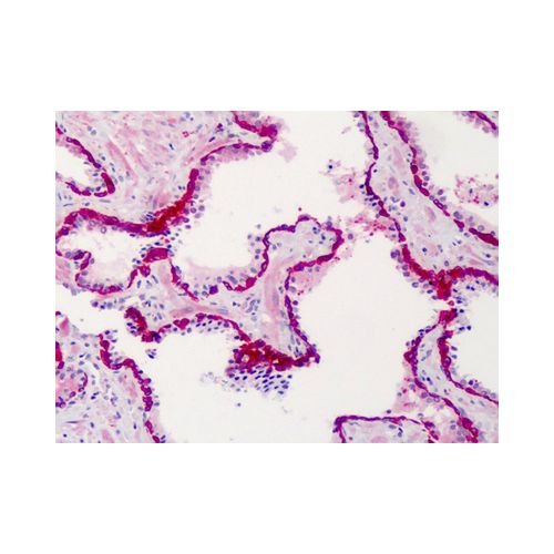 SLFN12 (C-Terminus) antibody
