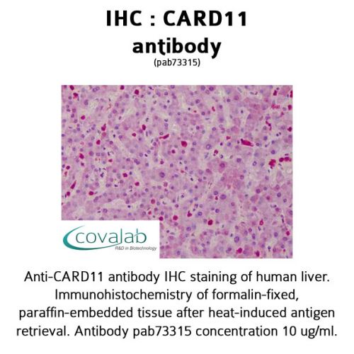 CARD11 antibody
