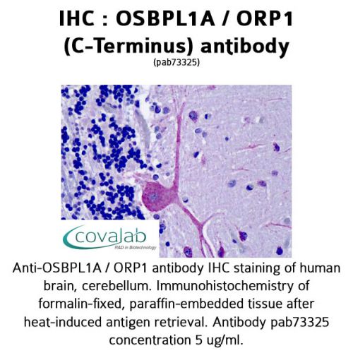OSBPL1A / ORP1 (C-Terminus) antibody
