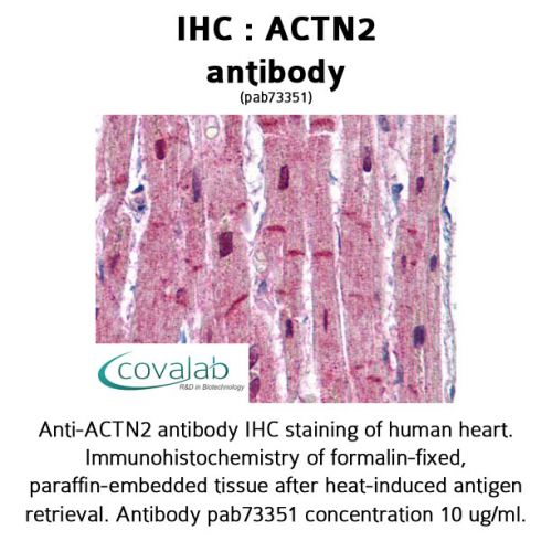 ACTN2 antibody